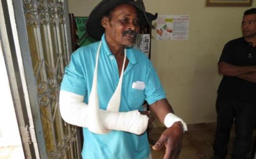 Sr. Antoninho, 11 pontos no rosto, fratura e ferimentos nos braços. Foto: Ewerton Libório/EAACONE